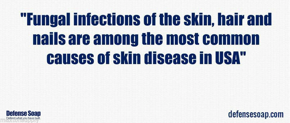 Defense Soap | Shower Gel | Antimicrobial Therapeutic | 8 Oz. 4 Defense Soap | Shower Gel | Antimicrobial Therapeutic | 8 Oz.